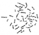 (b). A Copenhagen Chromosome Dataset Metaphase Plate